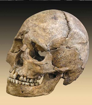 Skull