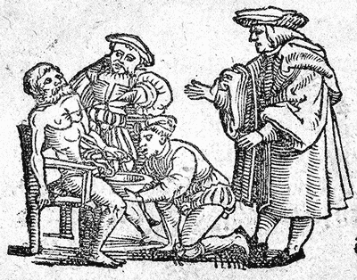 Bloodletting, 16th Century